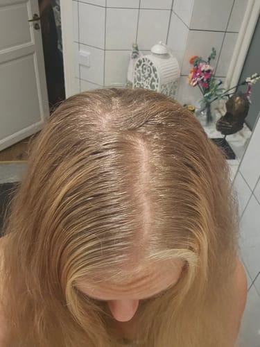 Customer photo review of Sunkissed Starter Kit