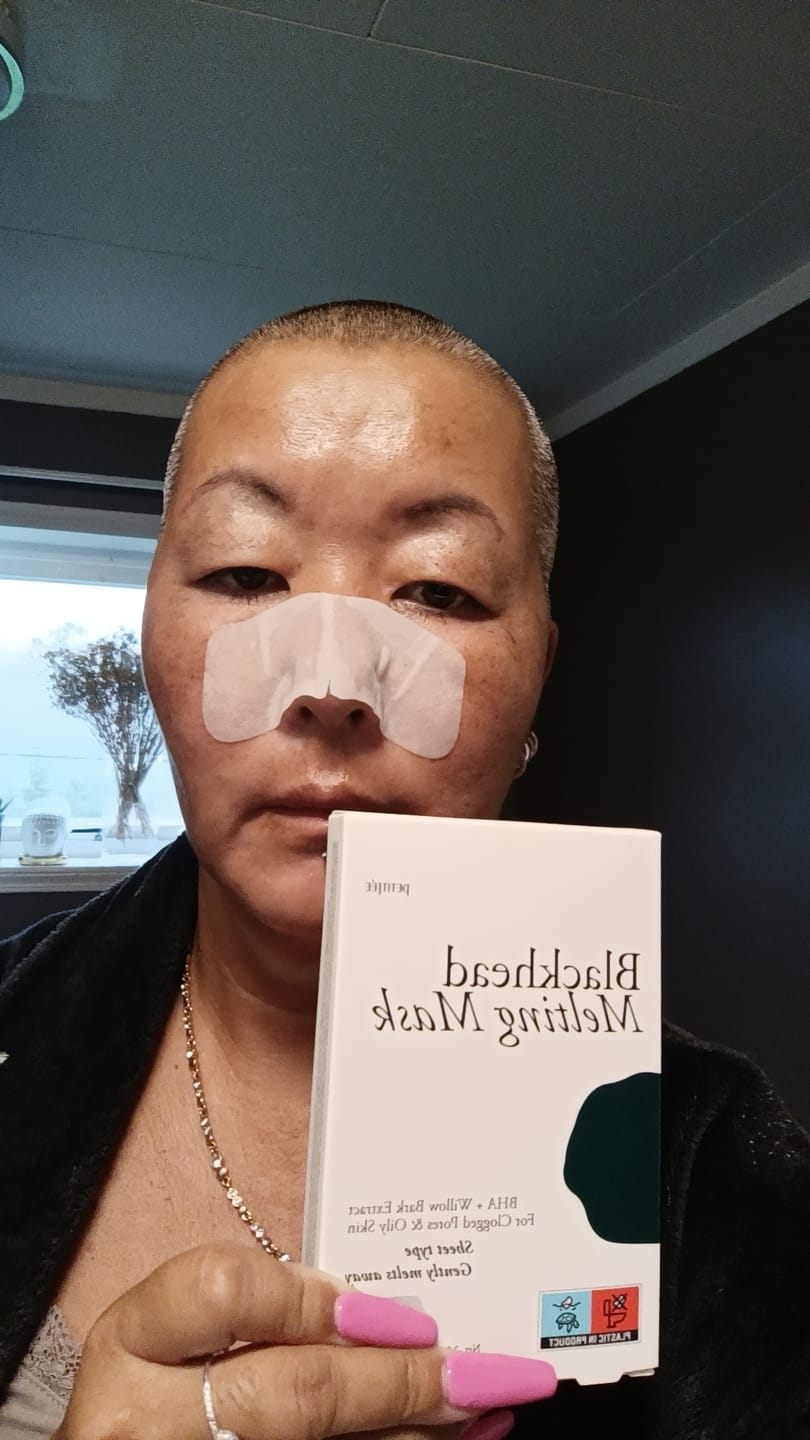 Customer photo review of Petitfee Blackhead Melting Mask (5stk)
