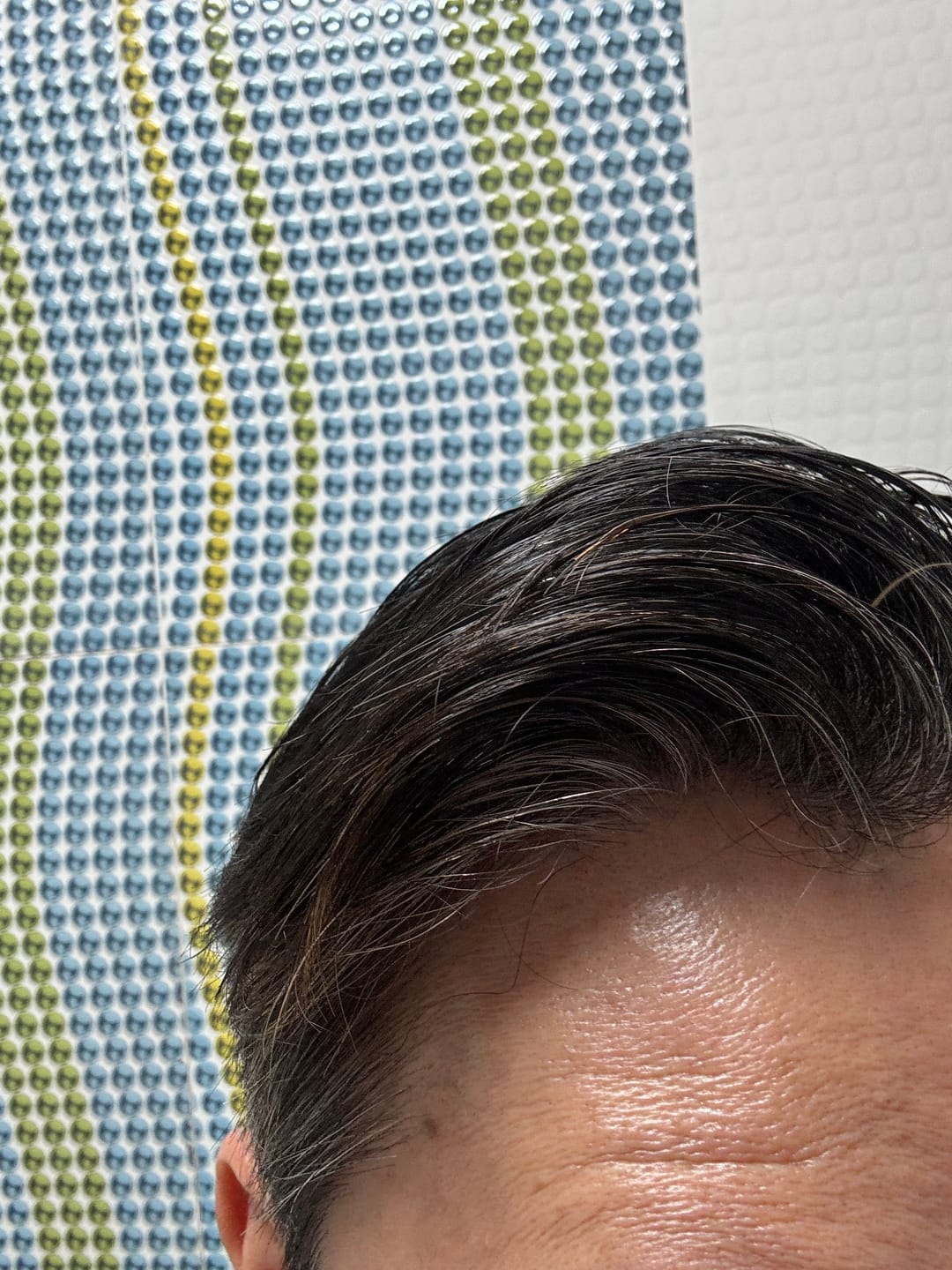 Customer photo review of Alpecin Grey Attack Caffeine & Colour Shampoo (200ml)