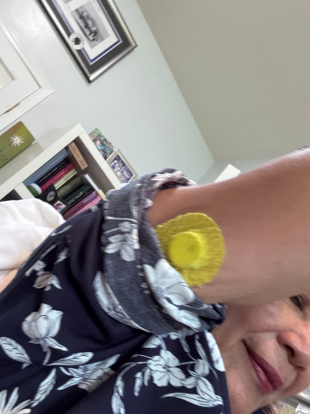 Customer photo review of Skin Grip Original - Libre 3 Adhesive Patches
