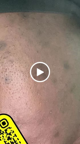 Customer video review of Shirley visage