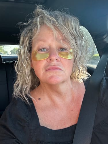 Customer photo review of Quia Collagen Eye Patches for Dark Circles & Puffiness