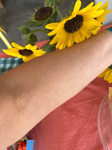 Customer photo review of Body Serum