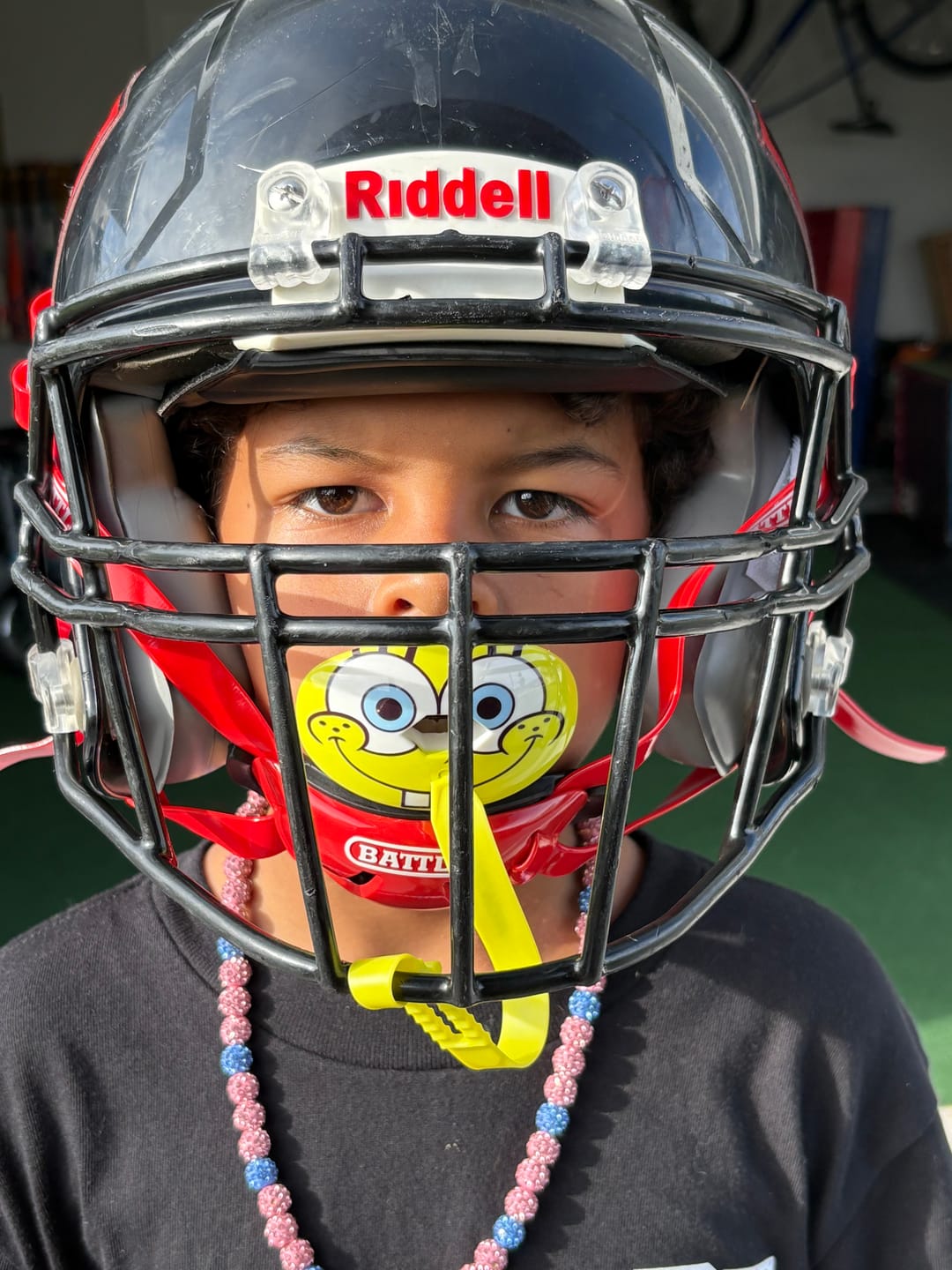 Customer photo review of Hexa-Flow: 'SpongeBob' Mouthguard