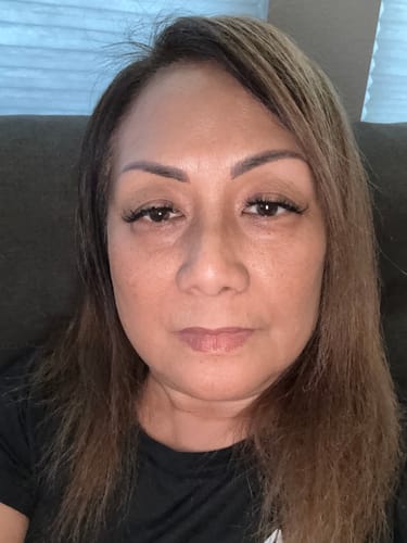 Customer photo review of Grass Fed Tallow & Honey Balm