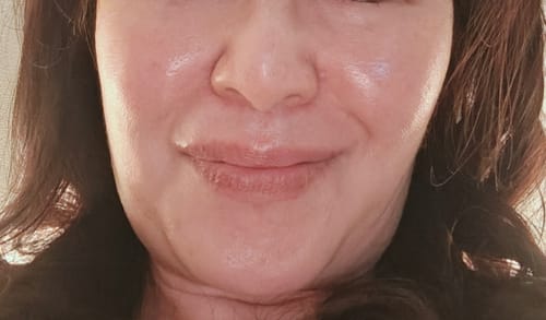 Customer photo review of OUTGLOW - Radiance Tri-Factor™ Jelly