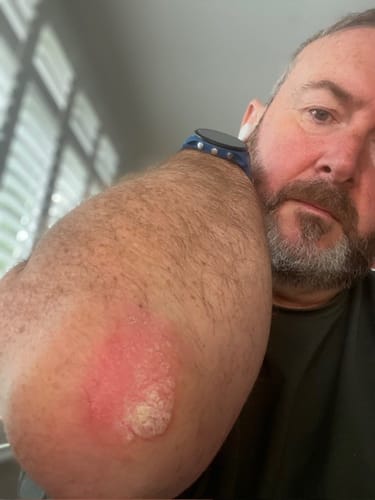 Customer photo review of Seb Natural Calming Serum