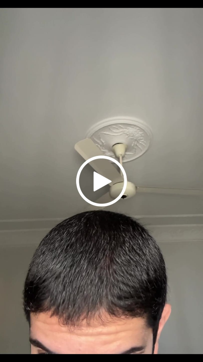 Customer video review of مجموعه الشعر من سيروم اكليل الجبل وشامبو السدر