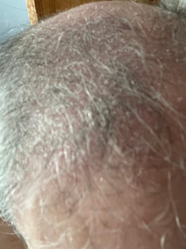 Customer photo review of Seb Natural Calming Serum