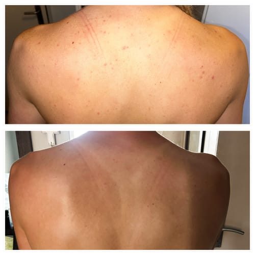 Customer photo review of Bumps Be Gone