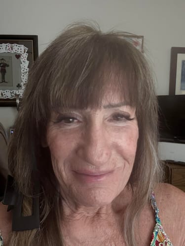 Customer photo review of 3 Month Supply - Seranova Micro Infusion System