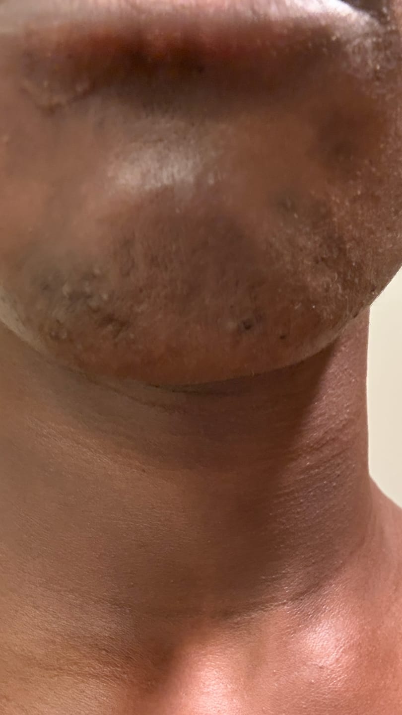Customer photo review of Melanin Skin Bundle (40% off)