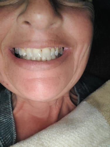 Customer photo review of Platinum Turbo Boost Accelerator Paste