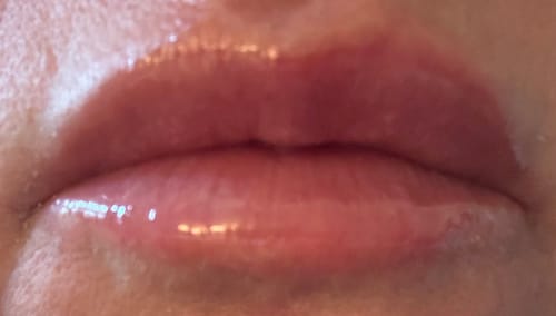 Customer photo review of Revision Skincare Youthful Lip Replenisher (Clear)