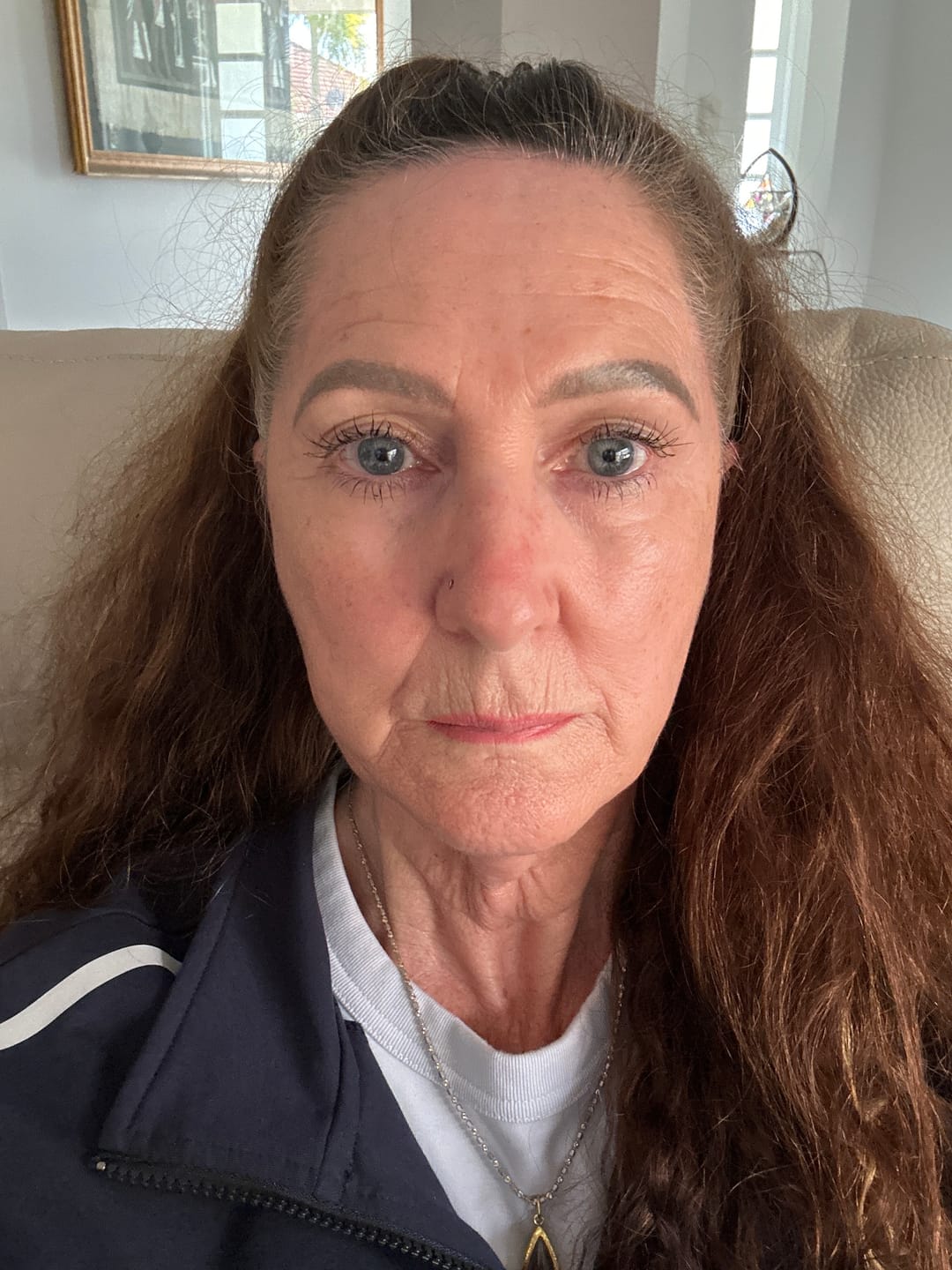 Customer photo review of Restore Serum