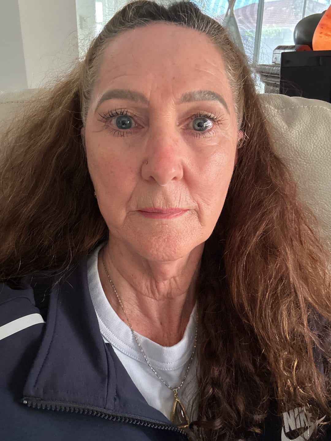 Customer photo review of Ageless AHA Glow Concentrate (free)