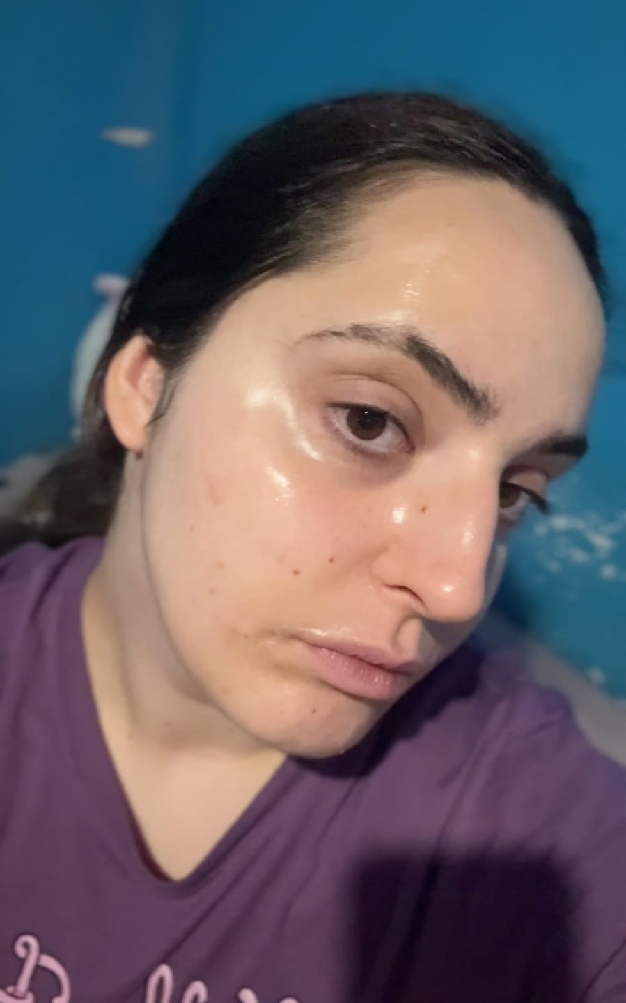 Customer photo review of Dark spot collagen wrapping mask Glutathione film