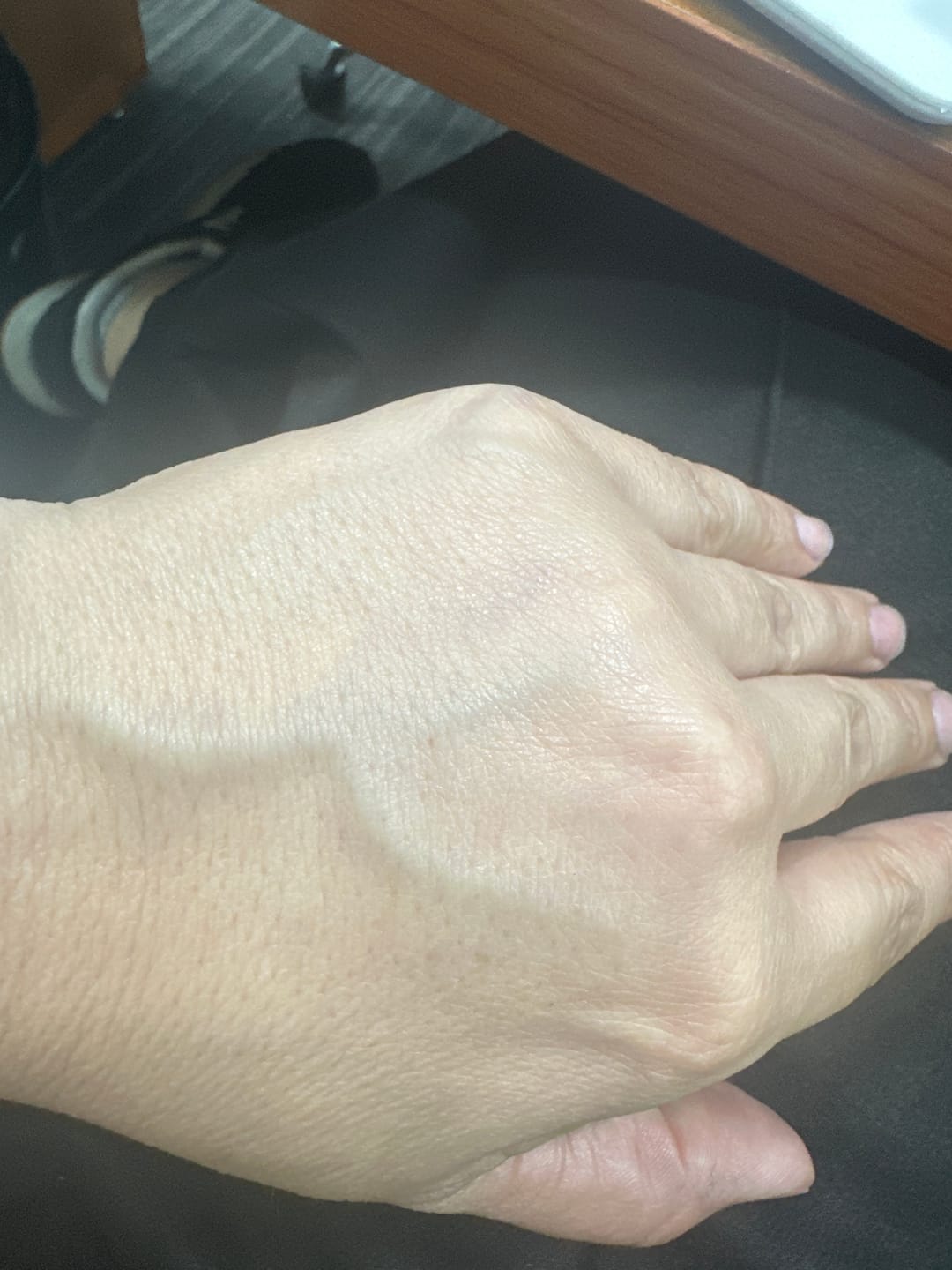 Customer photo review of Crema de Manos Reparadora