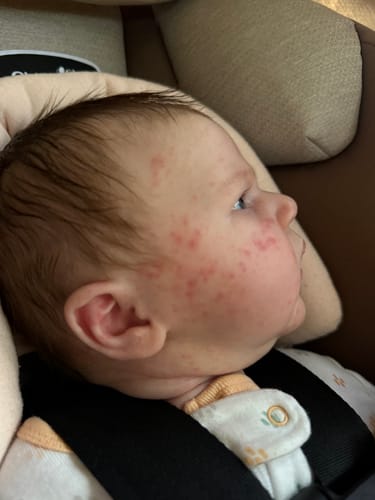 Customer photo review of All Over Ointment Original