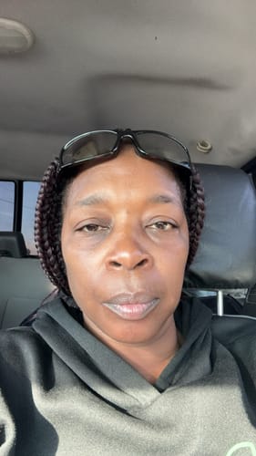 Customer photo review of Grass Fed Tallow & Honey Balm