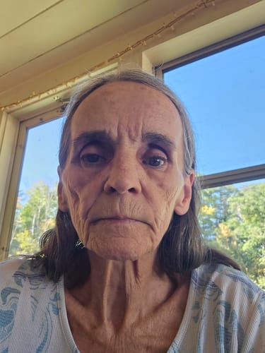 Customer photo review of Grass Fed Tallow & Honey Balm