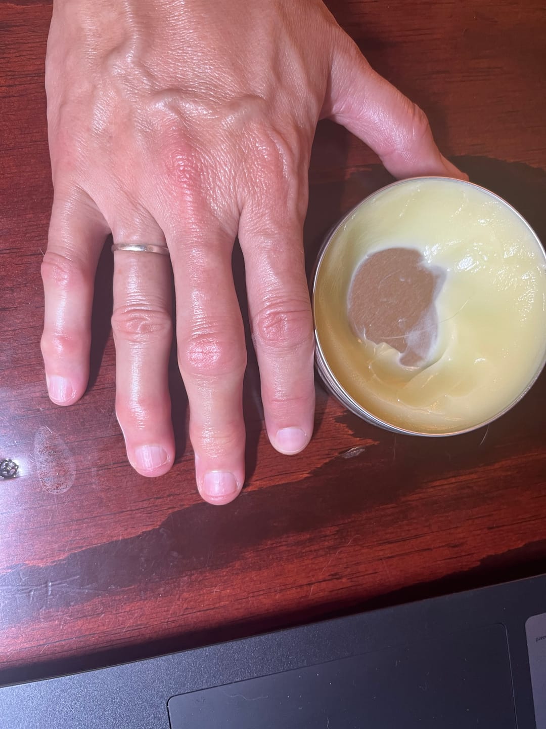 Customer photo review of Magic Muscle Balm - 113ml (4oz)