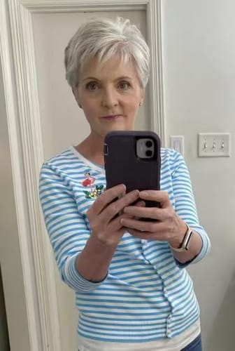 Customer photo review of Summer Breathable&comfortable Short Hair Topper For Thinning Hair