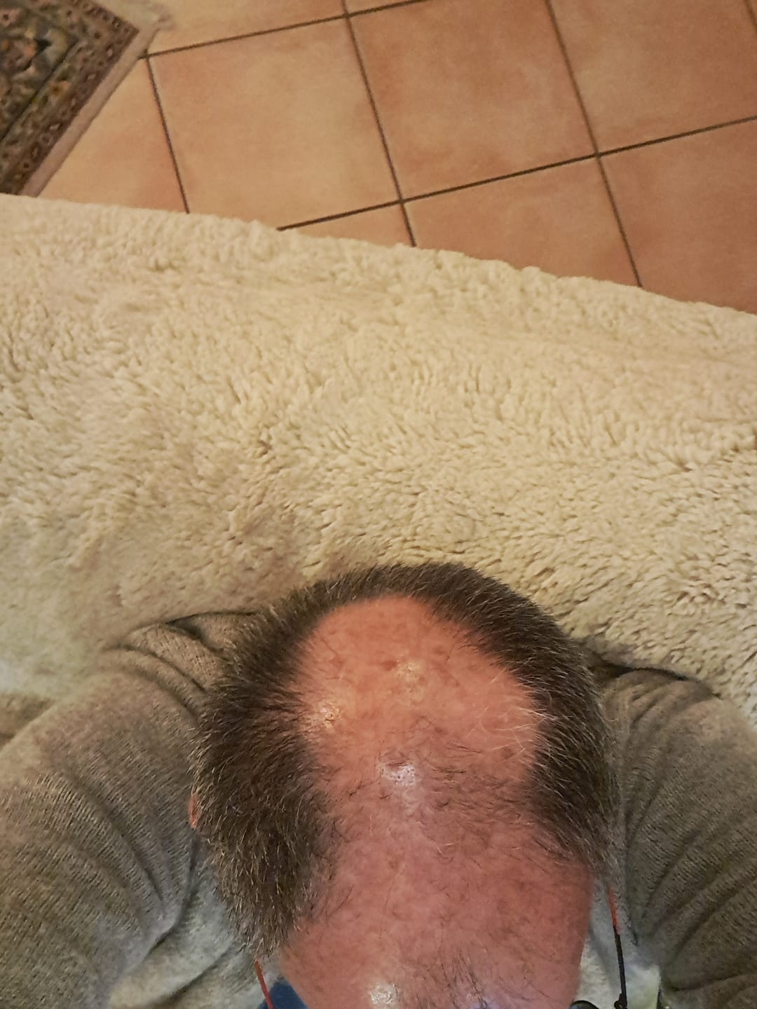 Customer photo review of SÉRUM CAPILLAIRE MULTI ACTIF BIO-DENSYL®