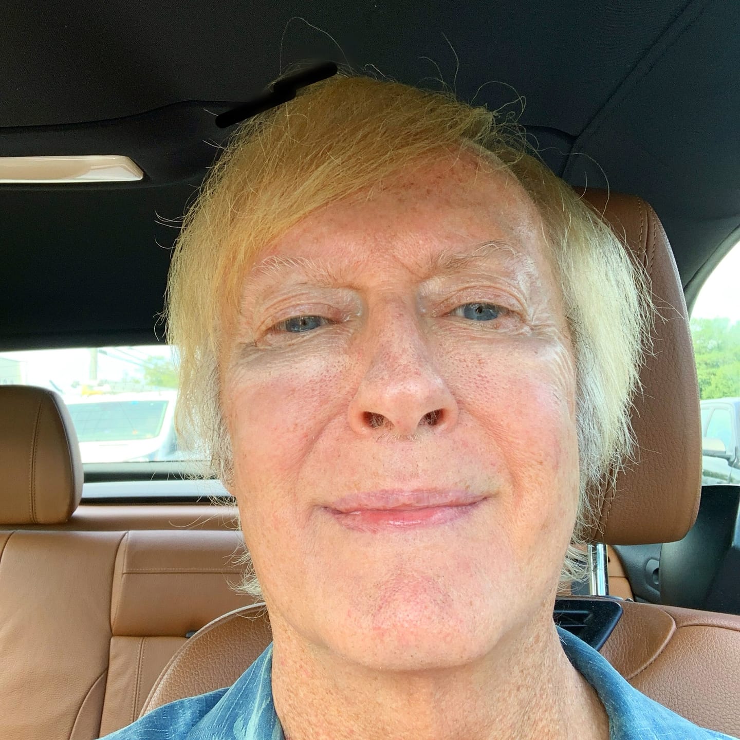 Customer photo review of Turmeric Dark Spot Removal Scrub