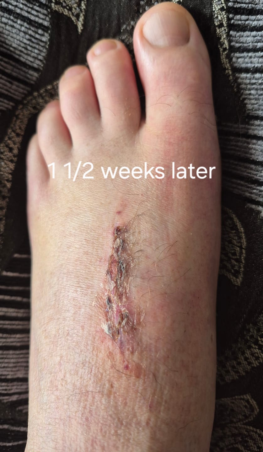 Customer photo review of TB500 & BPC Synergy - Advanced Peptide Support for Healing and Repair