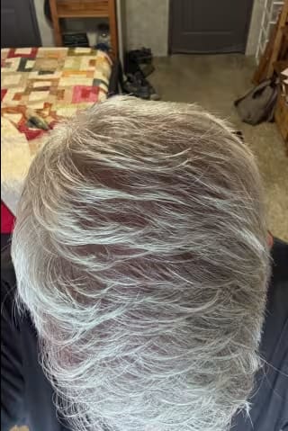 Customer photo review of SÉRUM CAPILLAIRE MULTI ACTIF BIO-DENSYL®