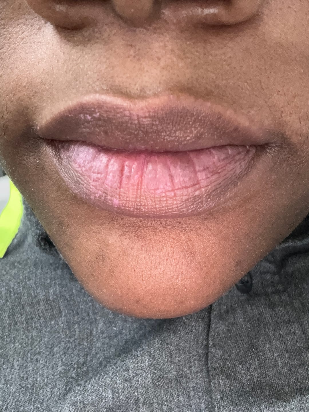 Customer photo review of Lips Lightening Cream For Men and Women (Results in 5 Days or Less)