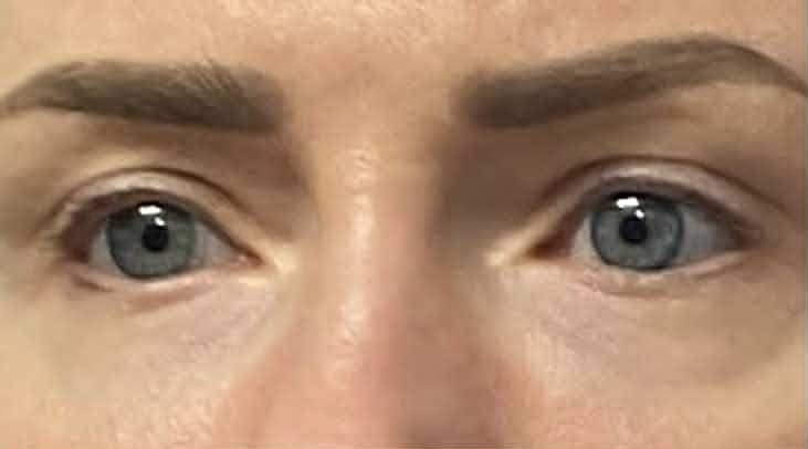 Customer photo review of Long Lashes Forever serum 4ml