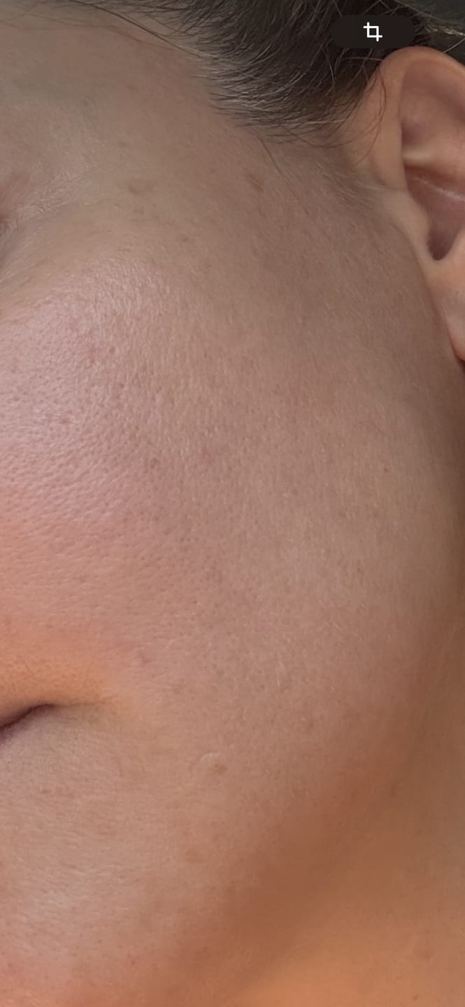 Customer photo review of Advanced Repair