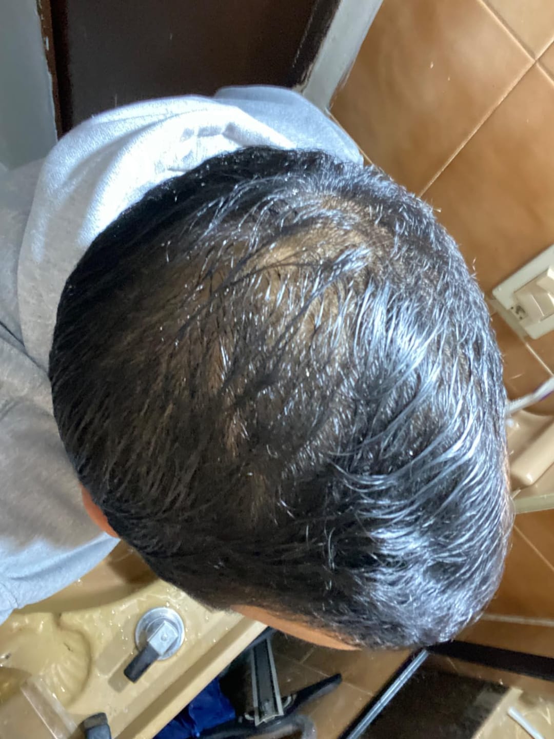 Customer photo review of SÉRUM CAPILLAIRE MULTI ACTIF BIO-DENSYL®