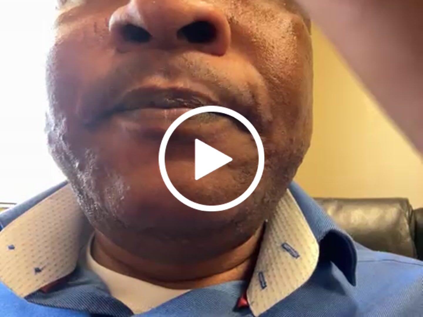 Customer video review of Lips Lightening Cream For Men and Women (Results in 5 Days or Less)