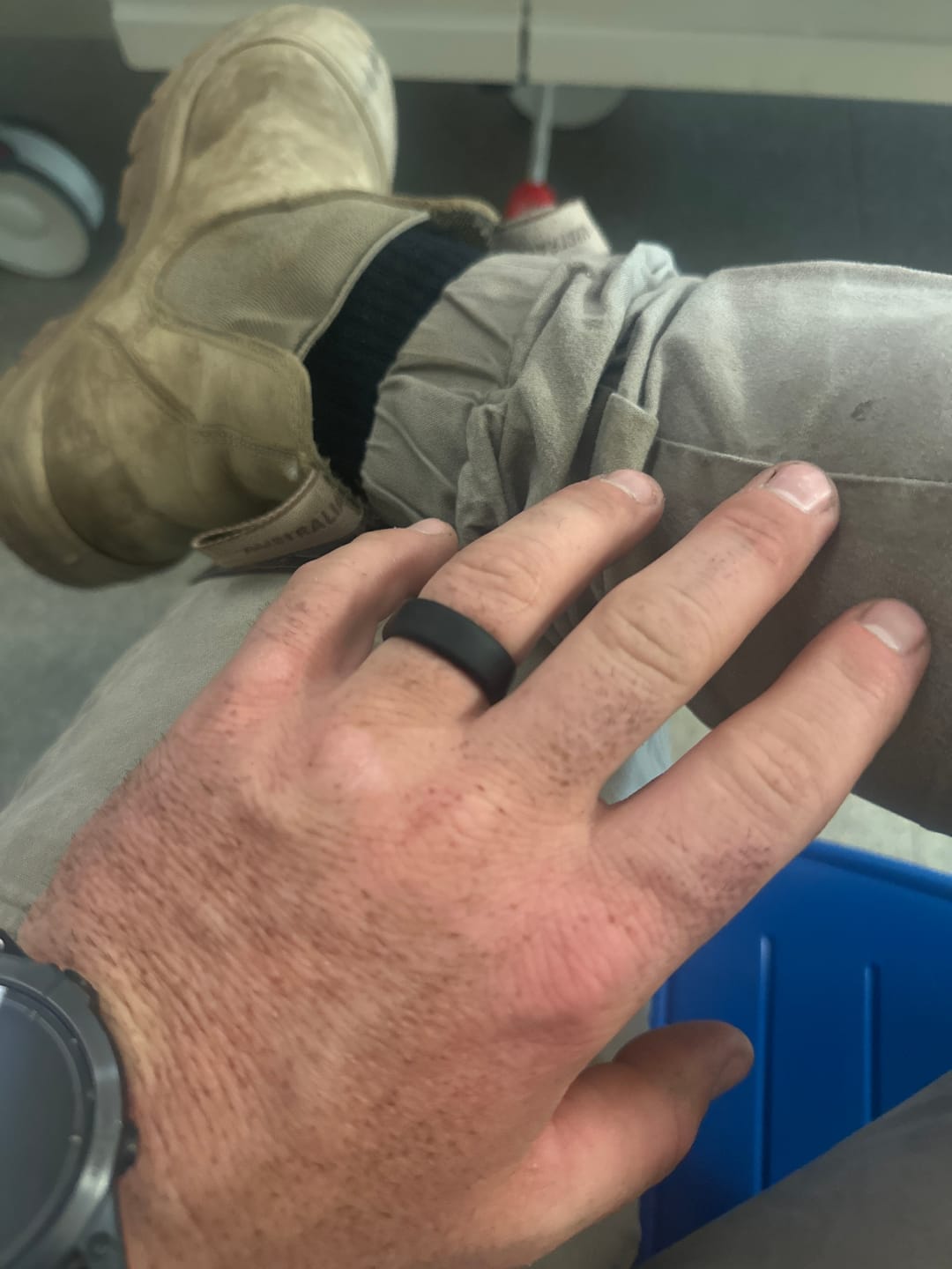 Customer photo review of The Obsidian - Silicone Ring