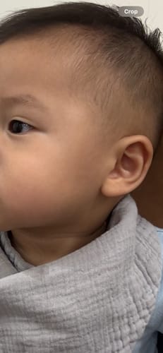 Customer photo review of All Over Ointment Eczema Treatment