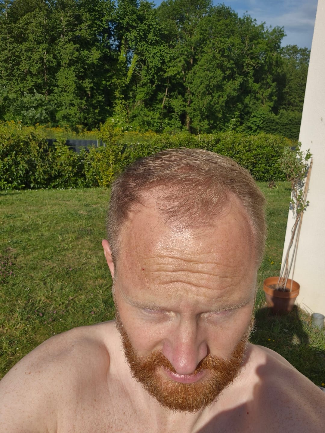 Customer photo review of SÉRUM CAPILLAIRE MULTI ACTIF BIO-DENSYL®