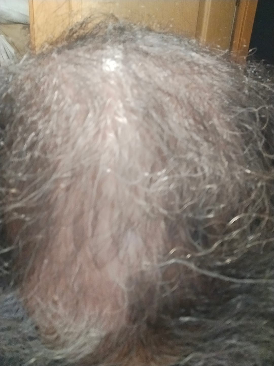 Customer photo review of SÉRUM CAPILLAIRE MULTI ACTIF BIO-DENSYL®