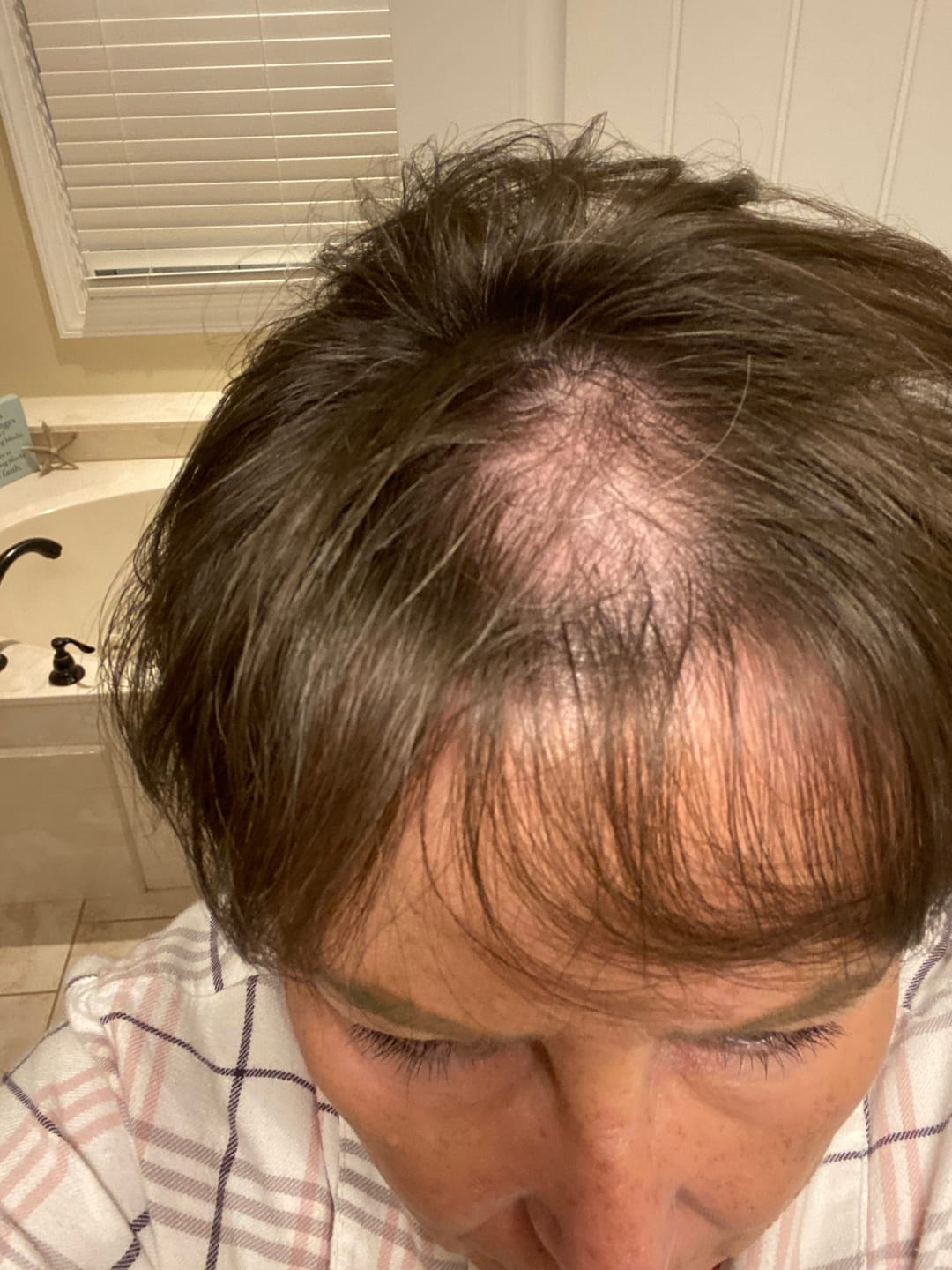 Customer photo review of SÉRUM CAPILLAIRE MULTI ACTIF BIO-DENSYL®