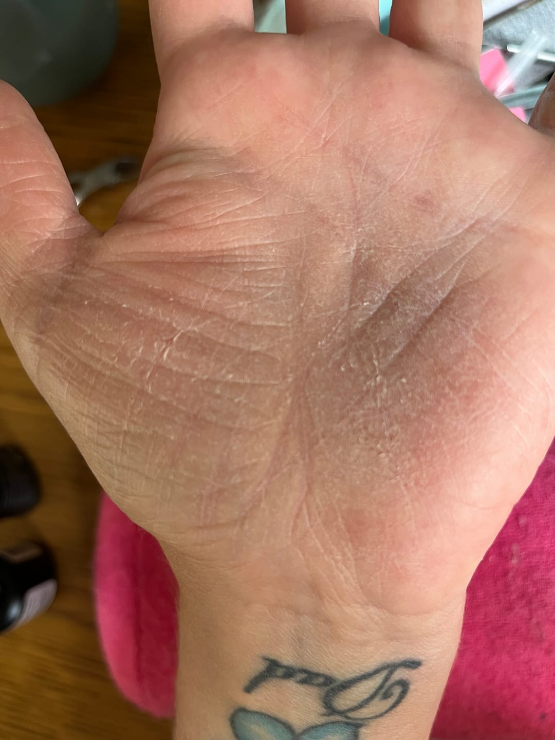 Customer photo review of Bioskin Zeoderm Skin Repair Moisturiser