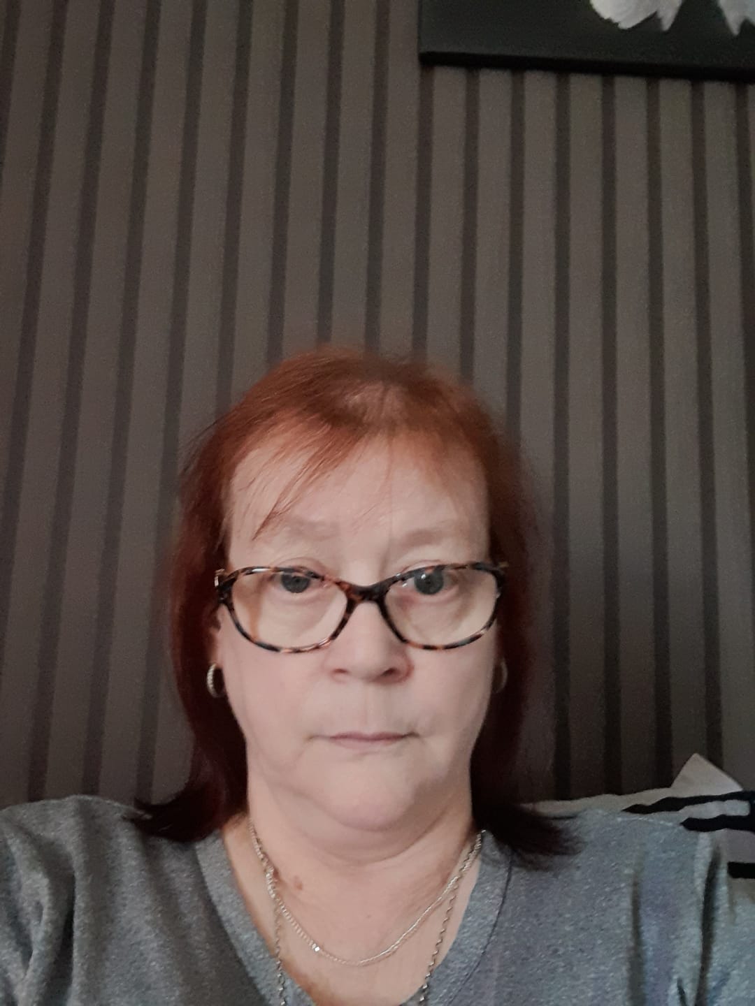 Customer photo review of SÉRUM CAPILLAIRE MULTI ACTIF BIO-DENSYL®