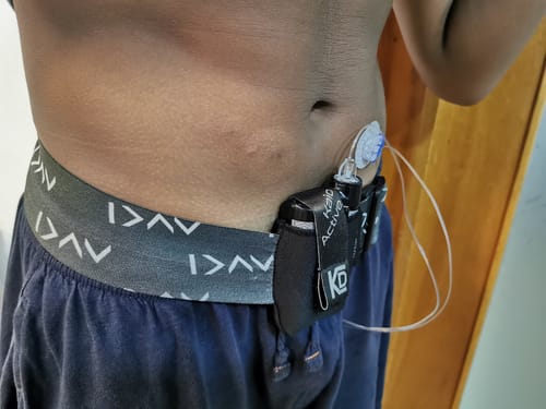 Customer photo review of Insulin Pump Leg Band and pouch - Dia-Unisex Sport Leg Band