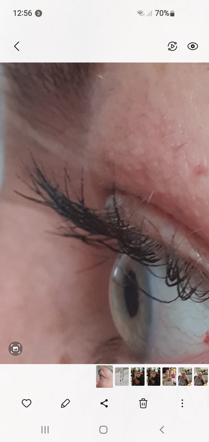 Customer photo review of KK Wimpernserum