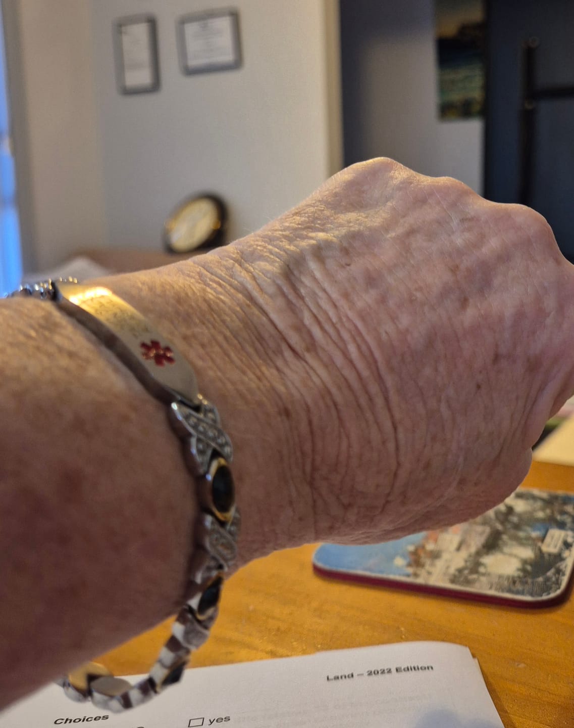 Customer photo review of Magnolia Spark Medical ID Bracelet