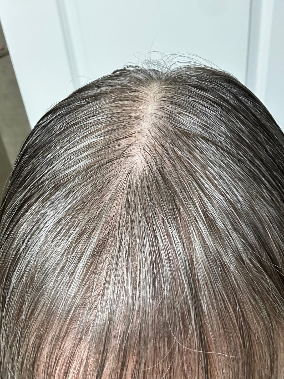 Customer photo review of SÉRUM CAPILLAIRE MULTI ACTIF BIO-DENSYL®