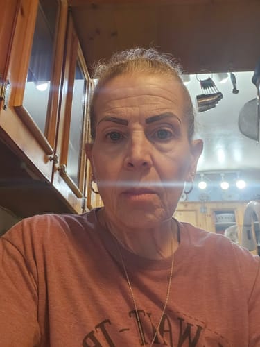 Customer photo review of Grass Fed Tallow & Honey Balm