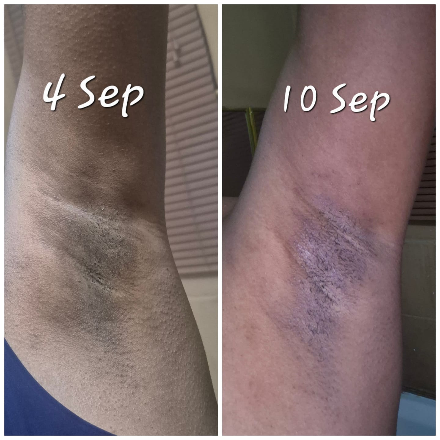 Customer photo review of Bright Skin Bish