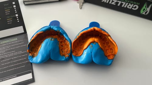 Customer photo review of Upper Impression Kit